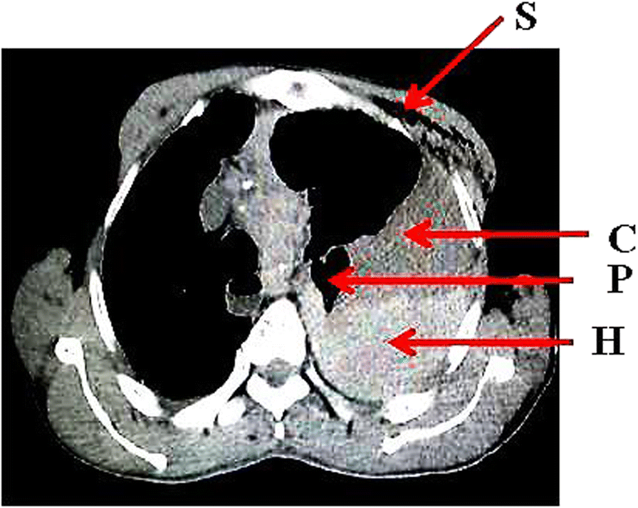 Fig. 8