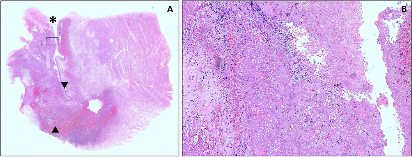 Fig. 2