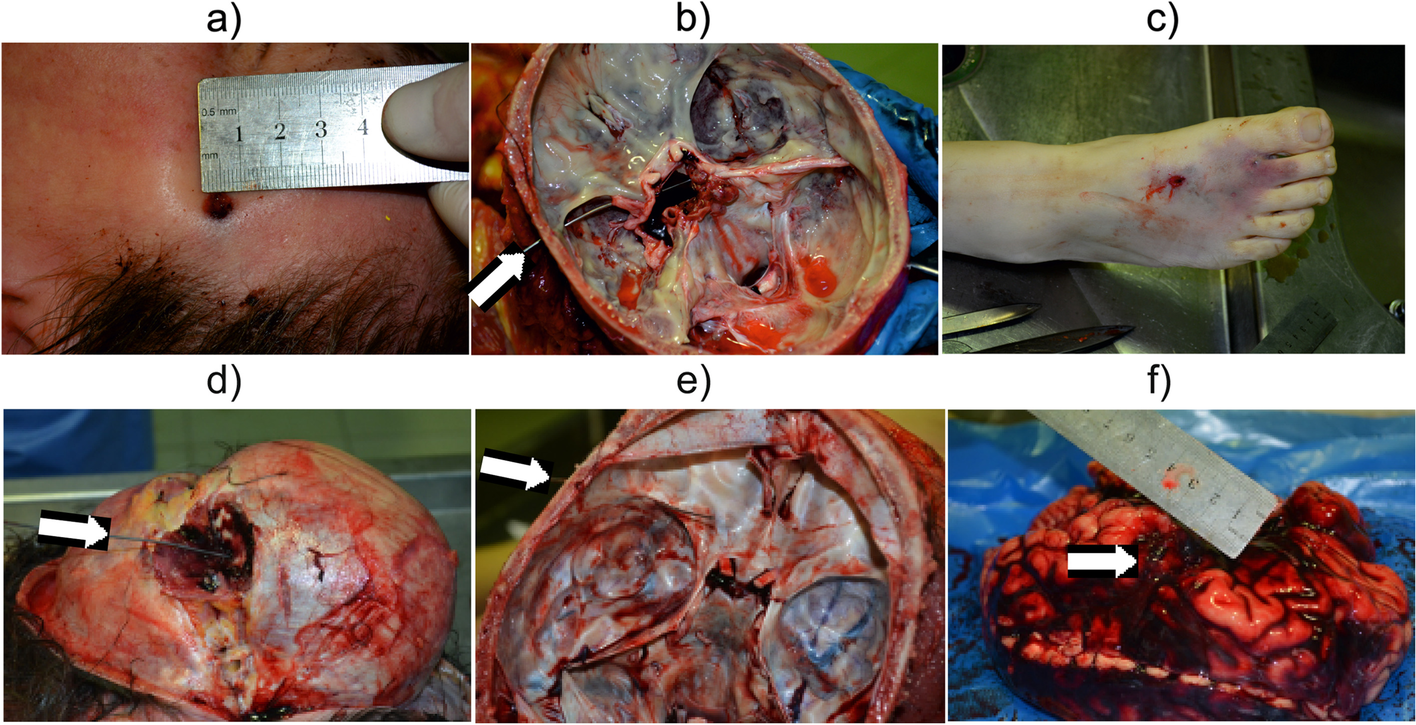 Fig. 3