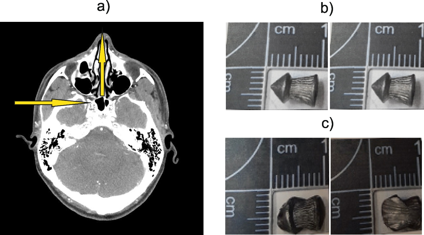 Fig. 4