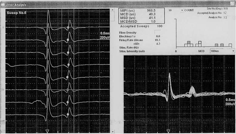 Fig. 2