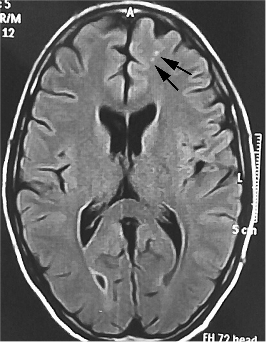 Fig. 2