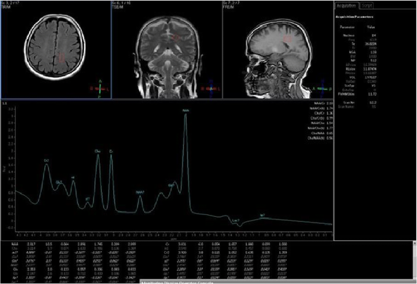 Fig. 3