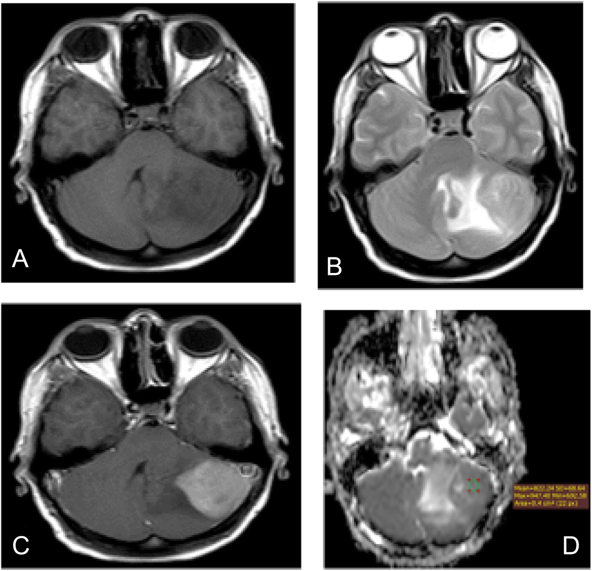 Fig. 4