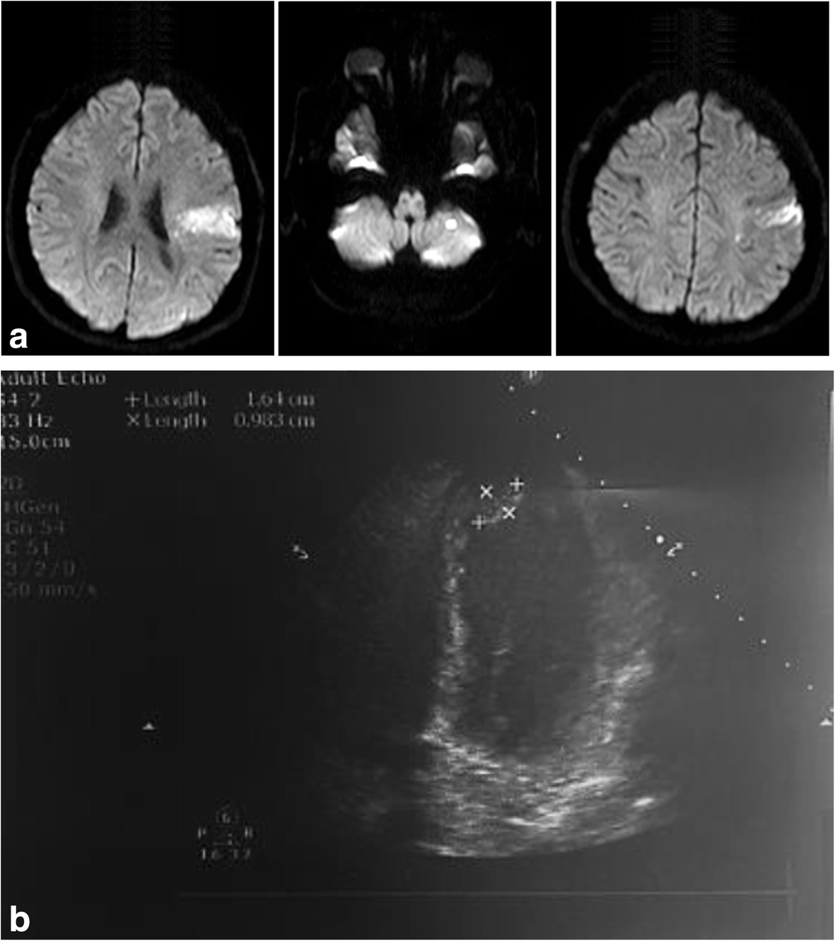 Fig. 2