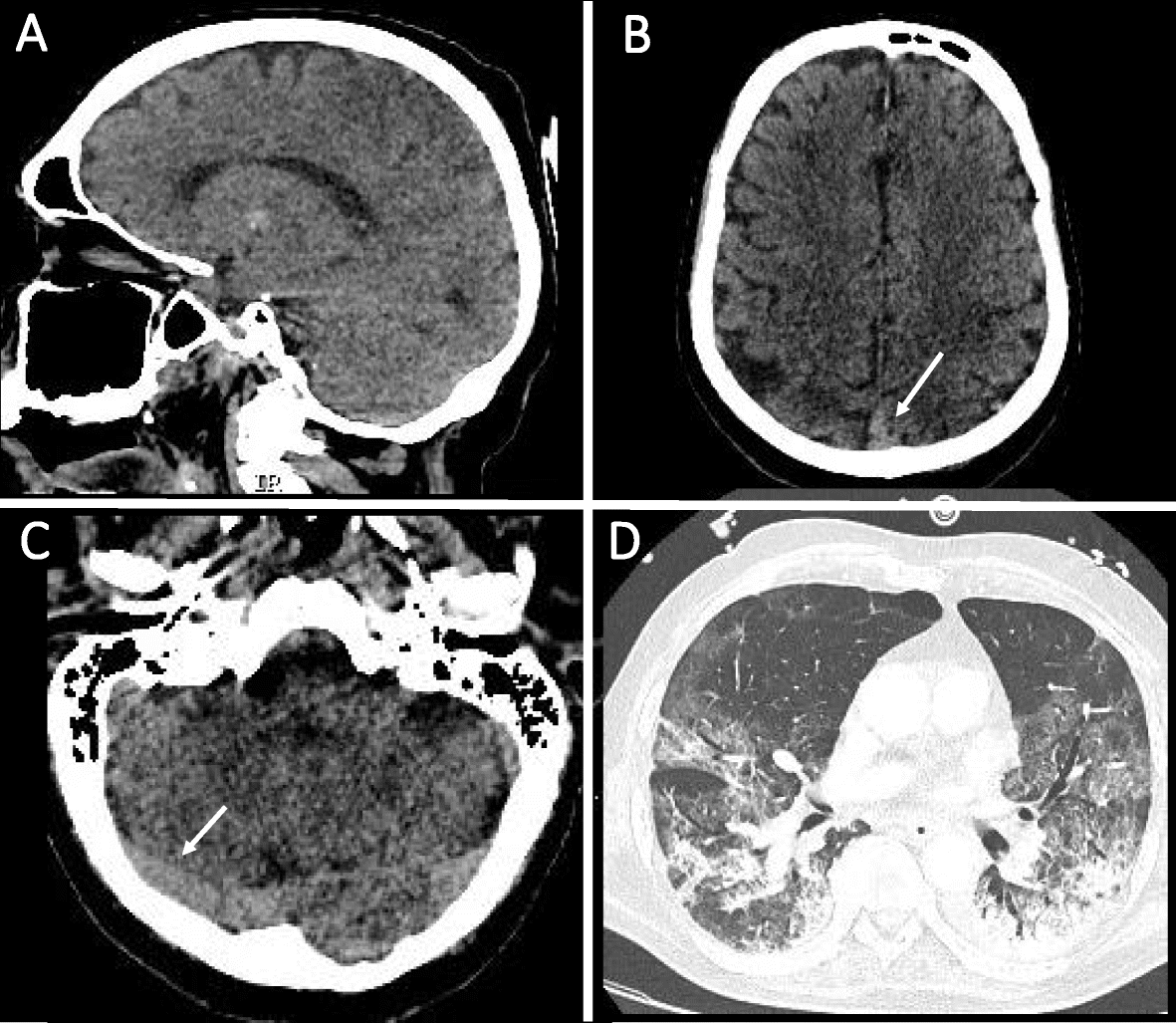 Fig. 2