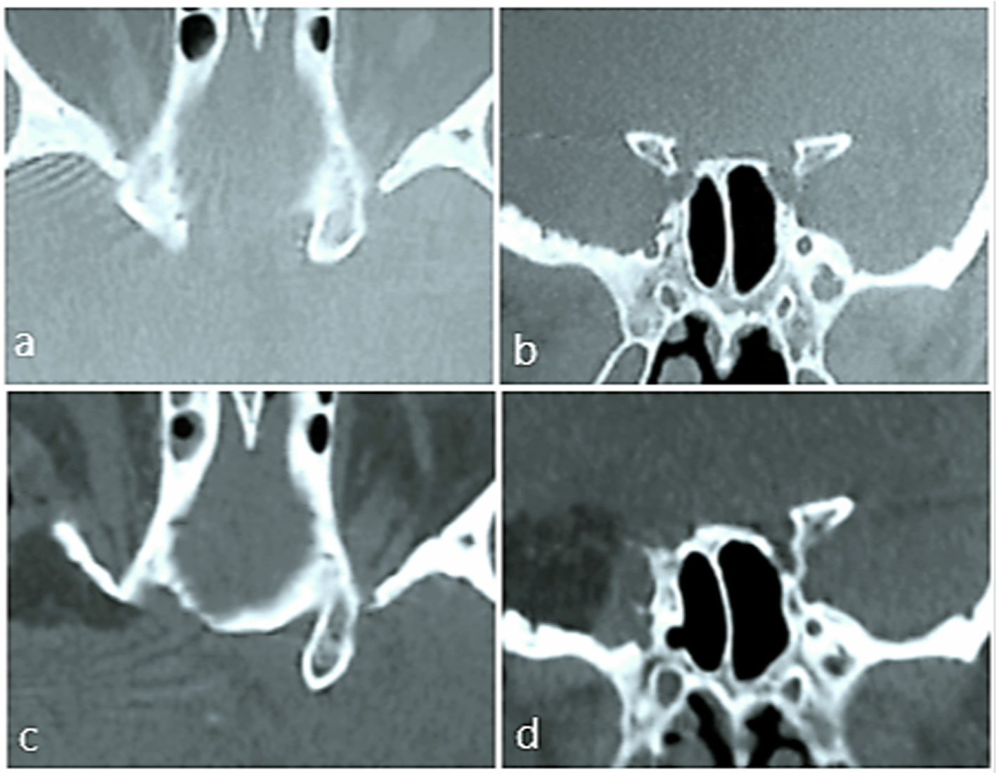 Fig. 2