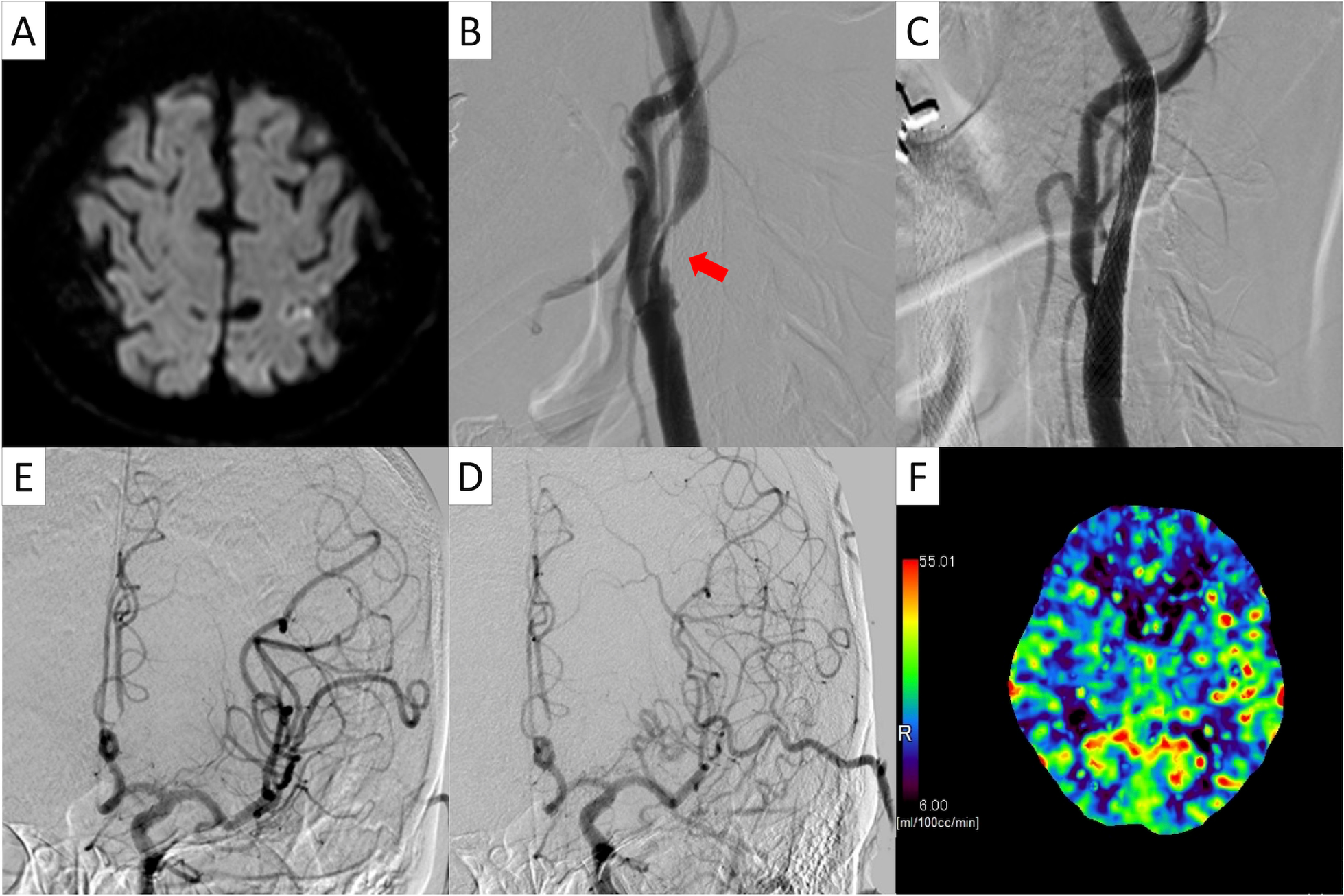 Fig. 1