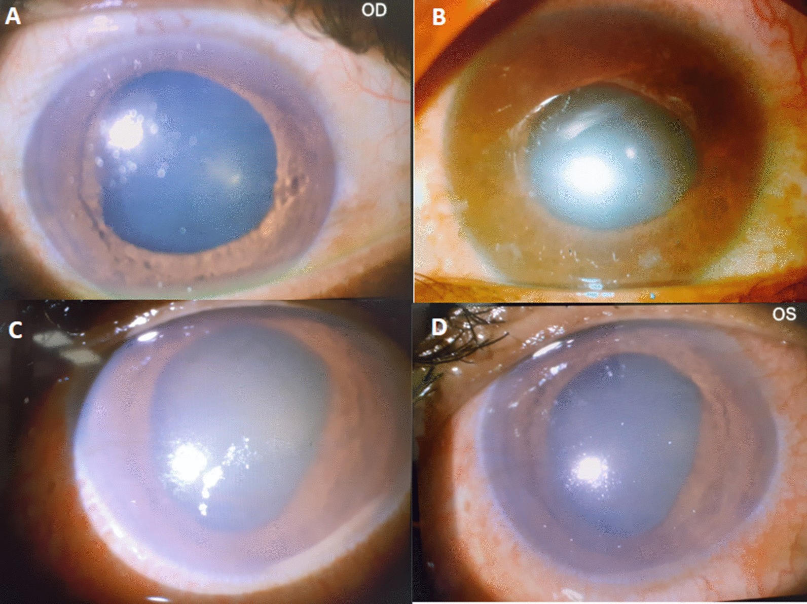 Fig. 1