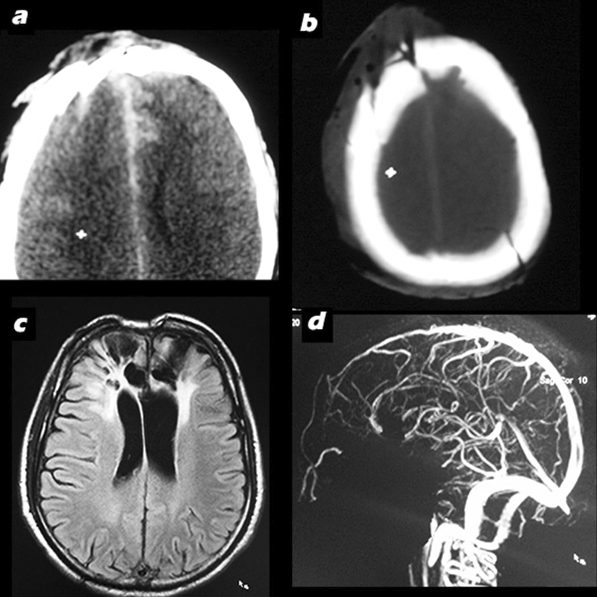 Fig. 2