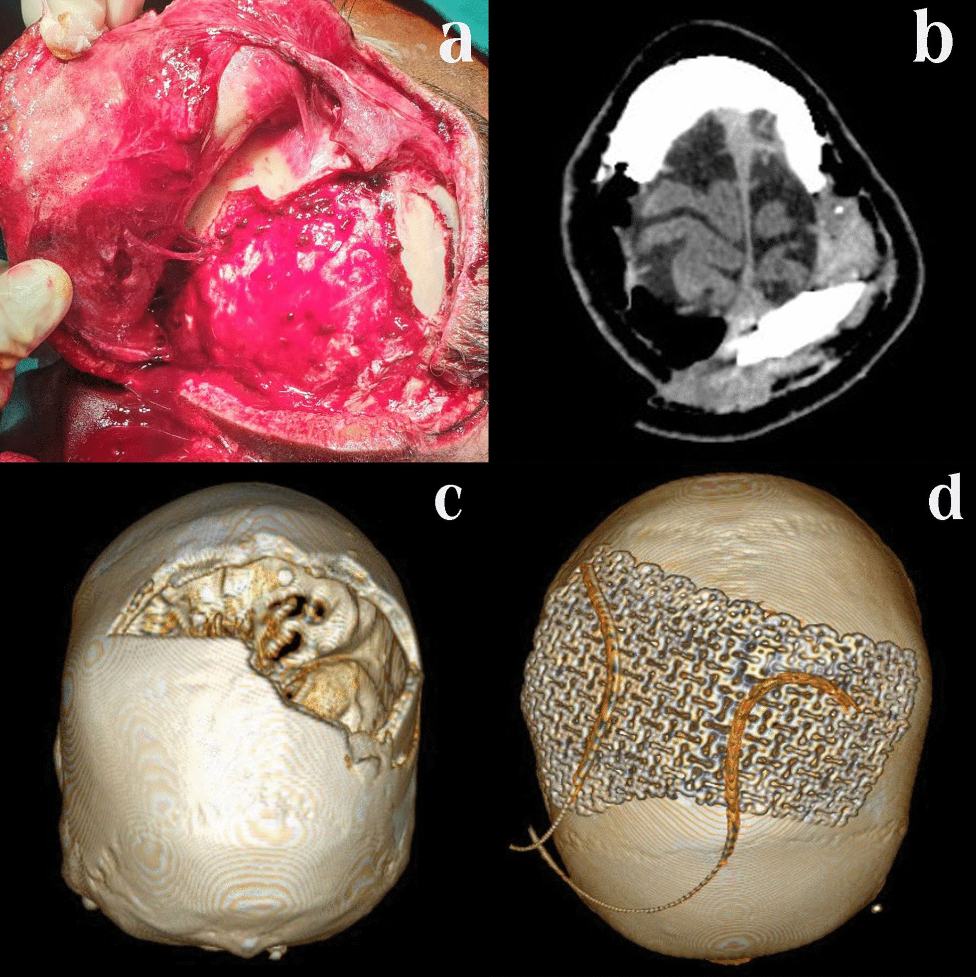 Fig. 5