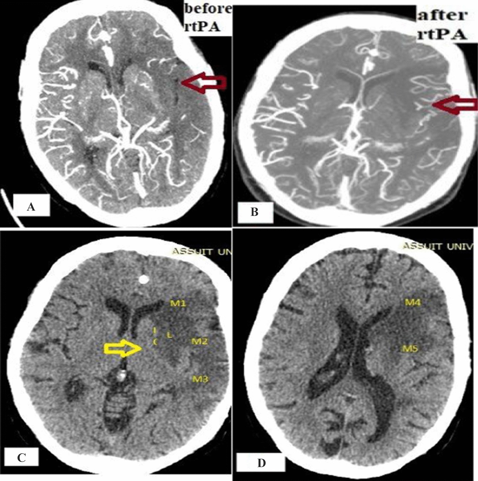 Fig. 4