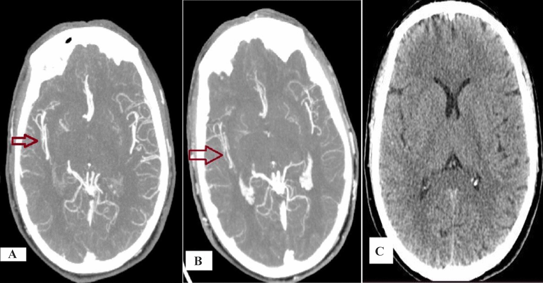 Fig. 5