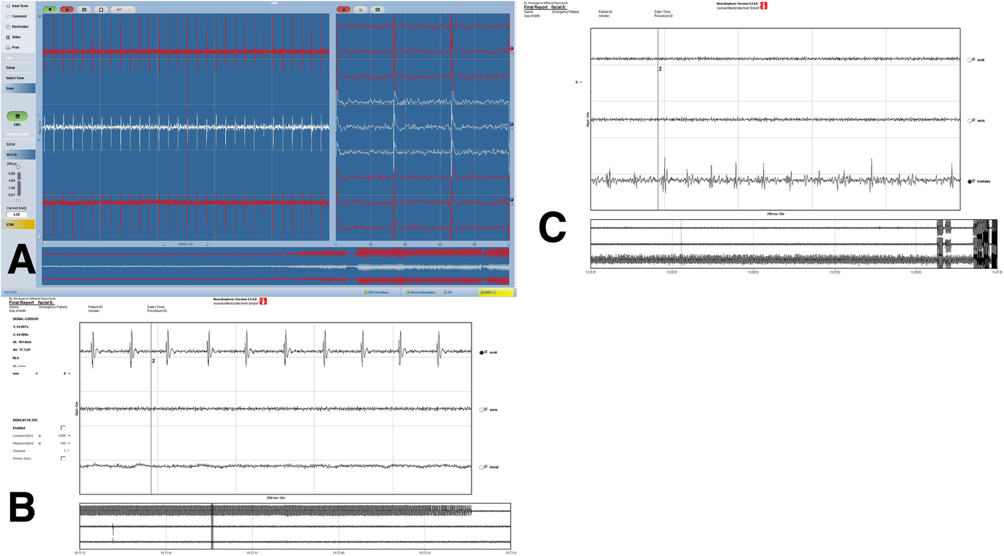 Fig. 2