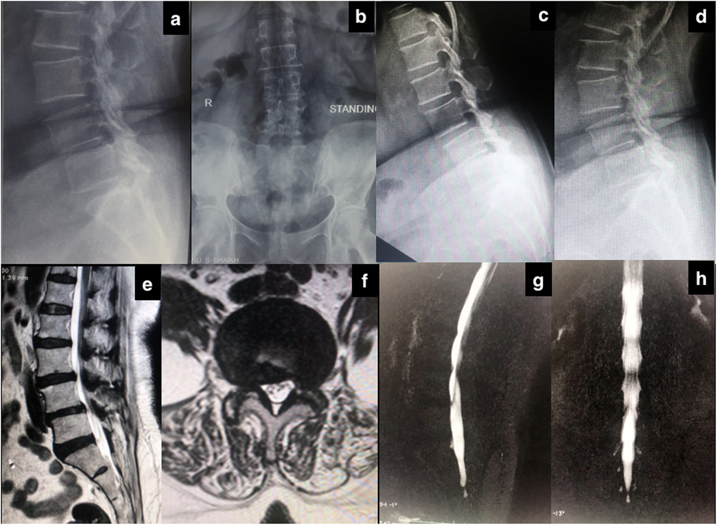 Fig. 6