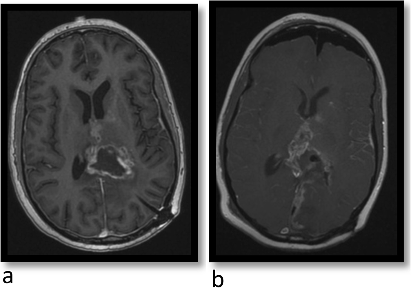 Fig. 11