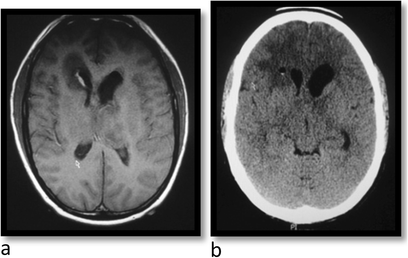 Fig. 12