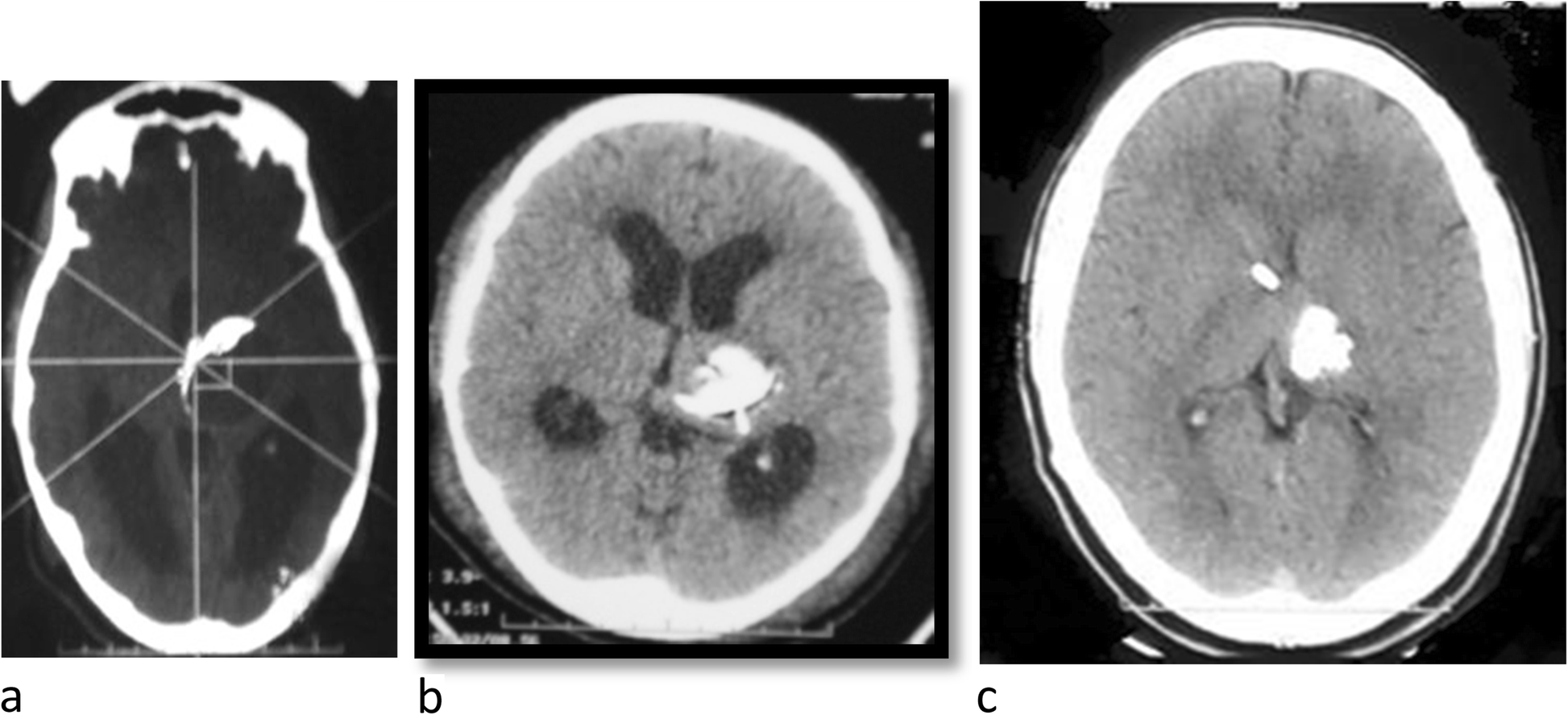 Fig. 6