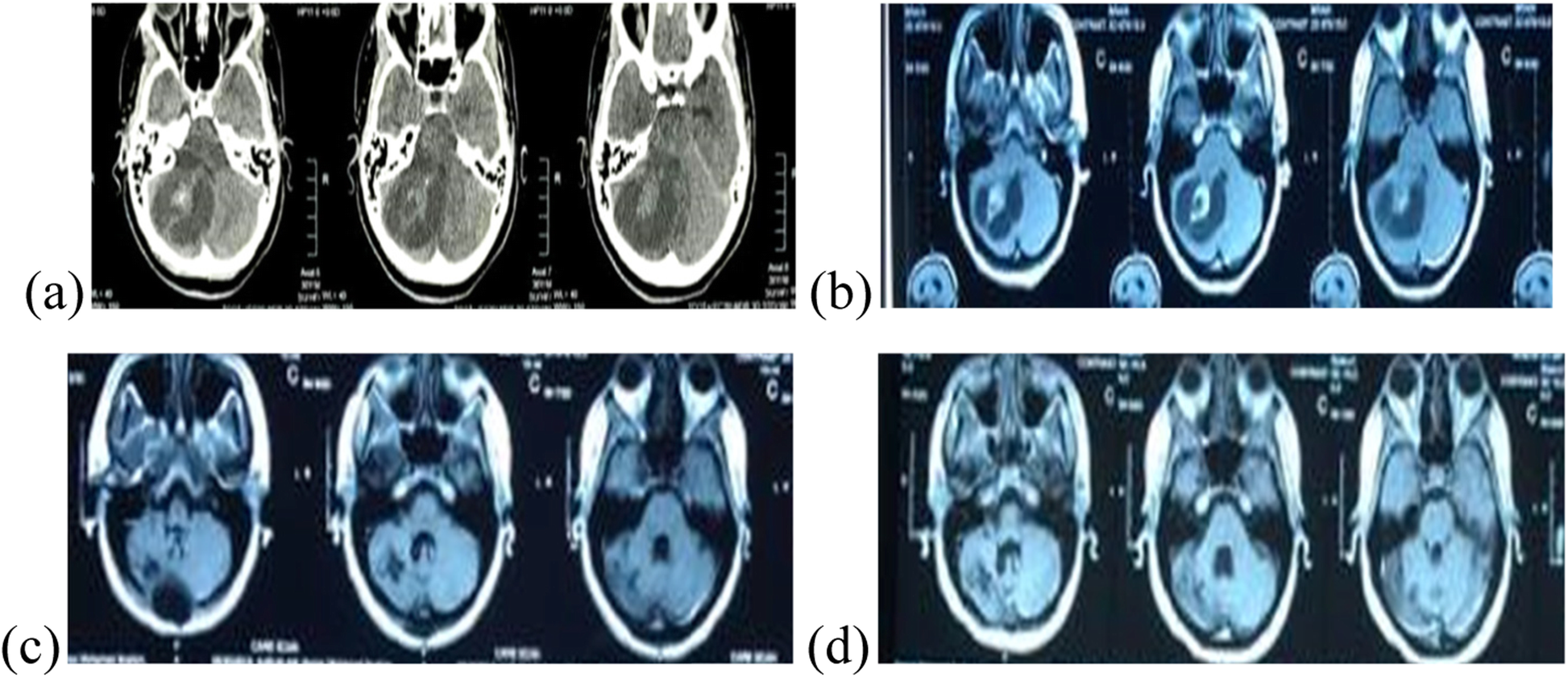 Fig. 4