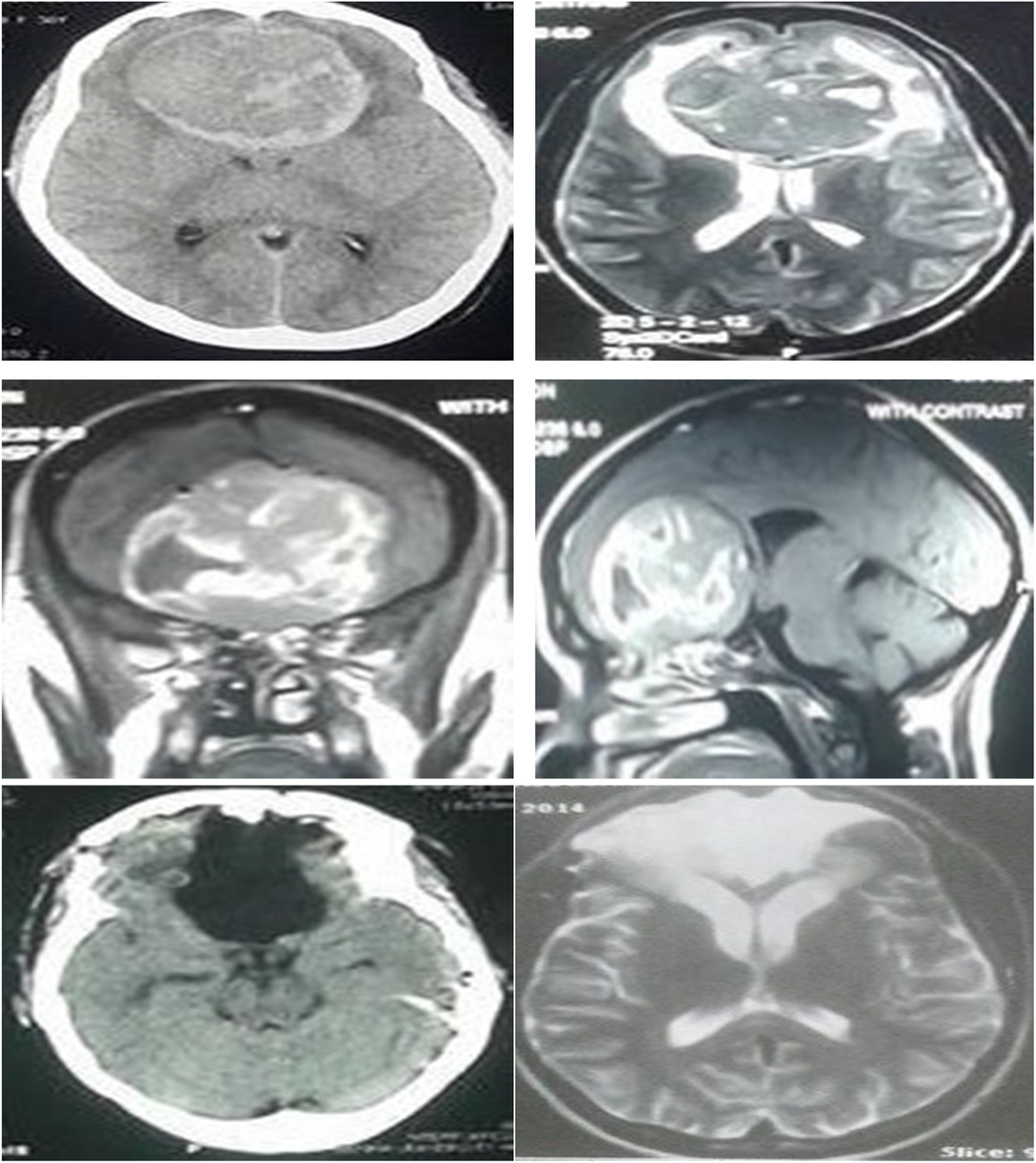 Fig. 1