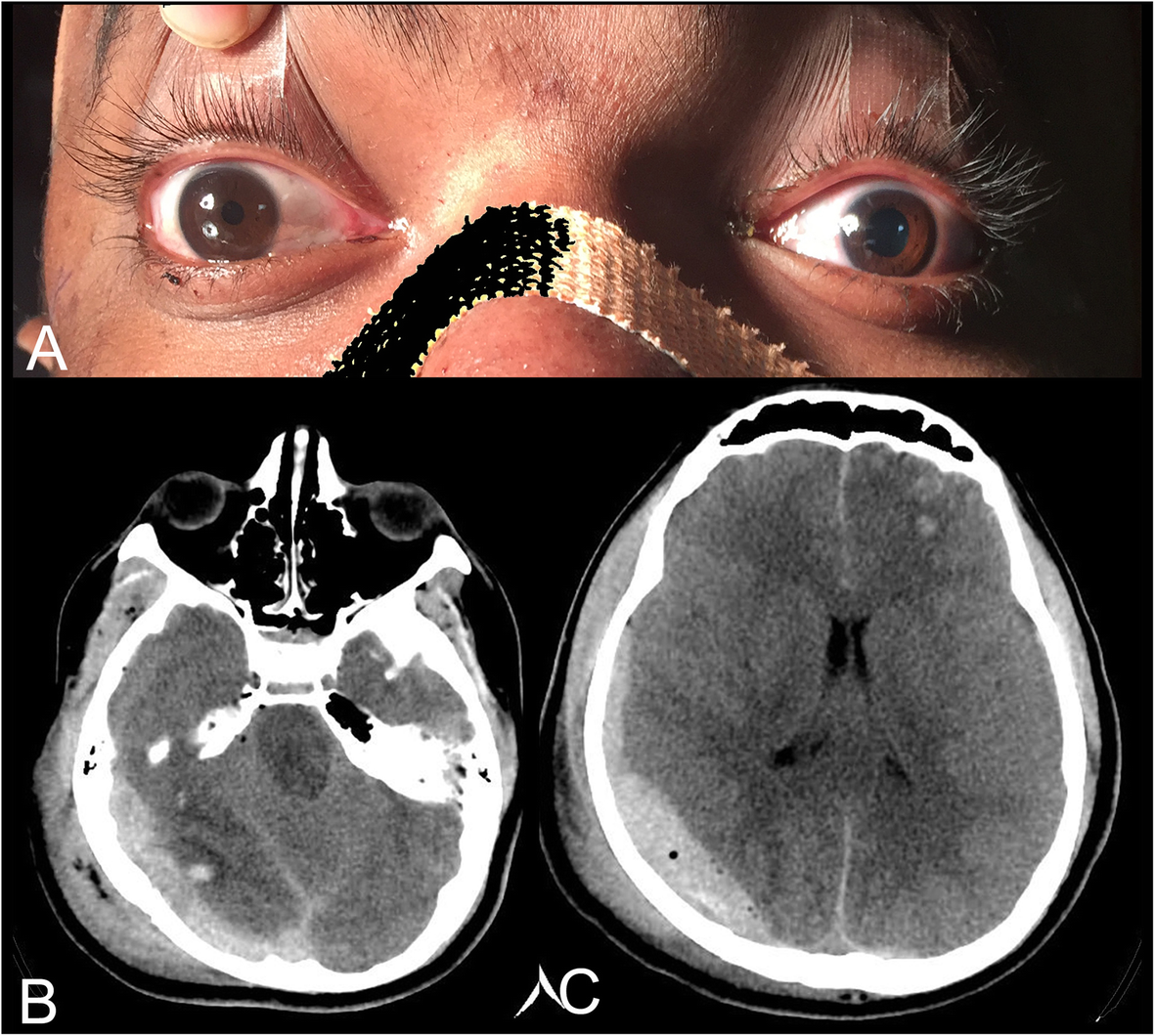 Fig. 1