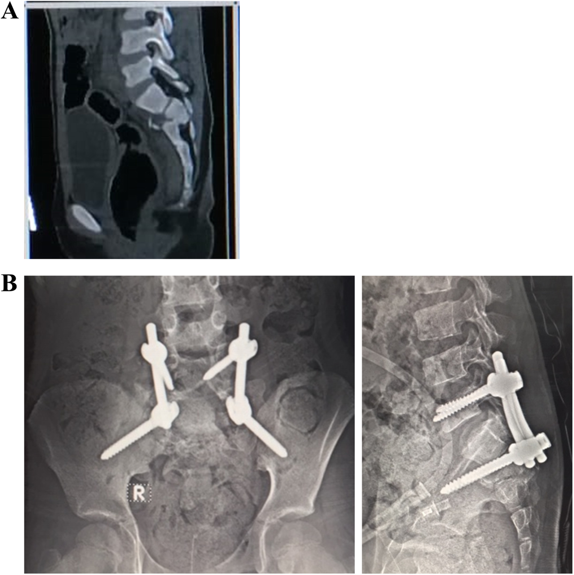 Fig. 1