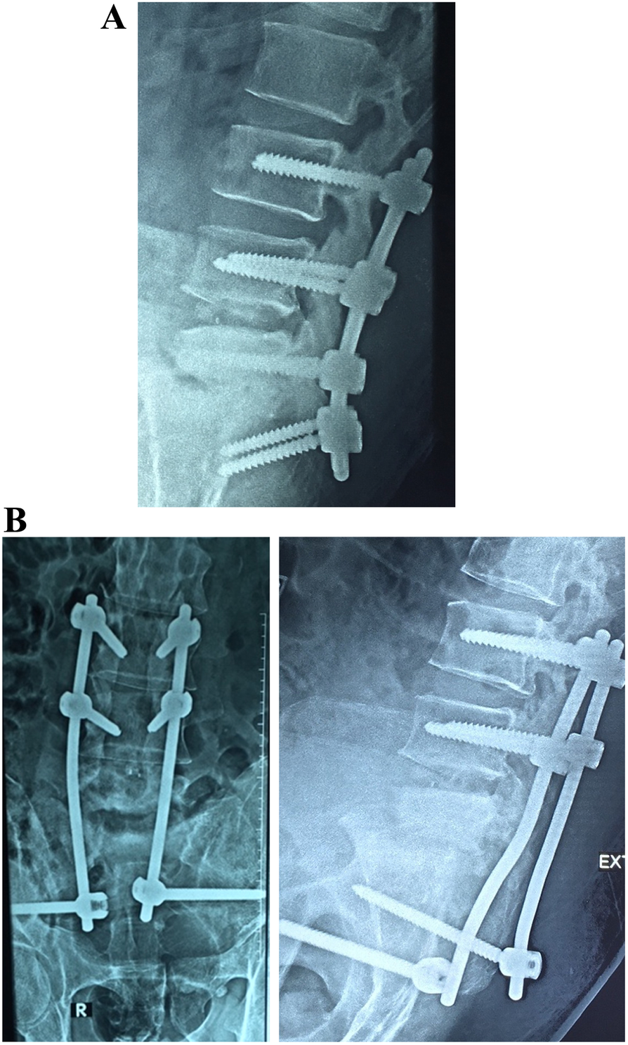 Fig. 6