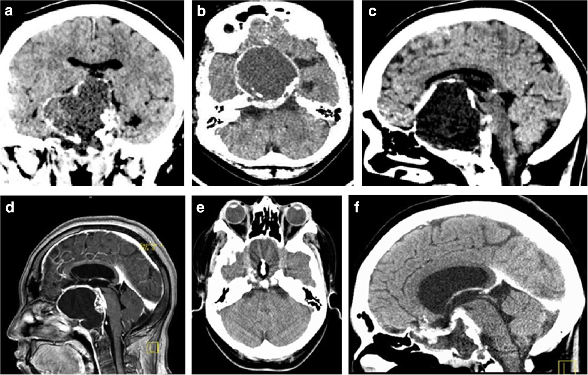 Fig. 4