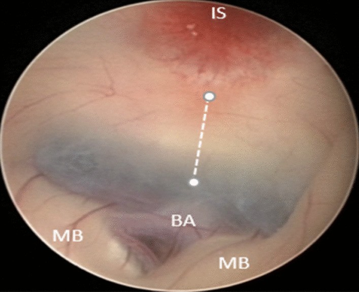 Fig. 2