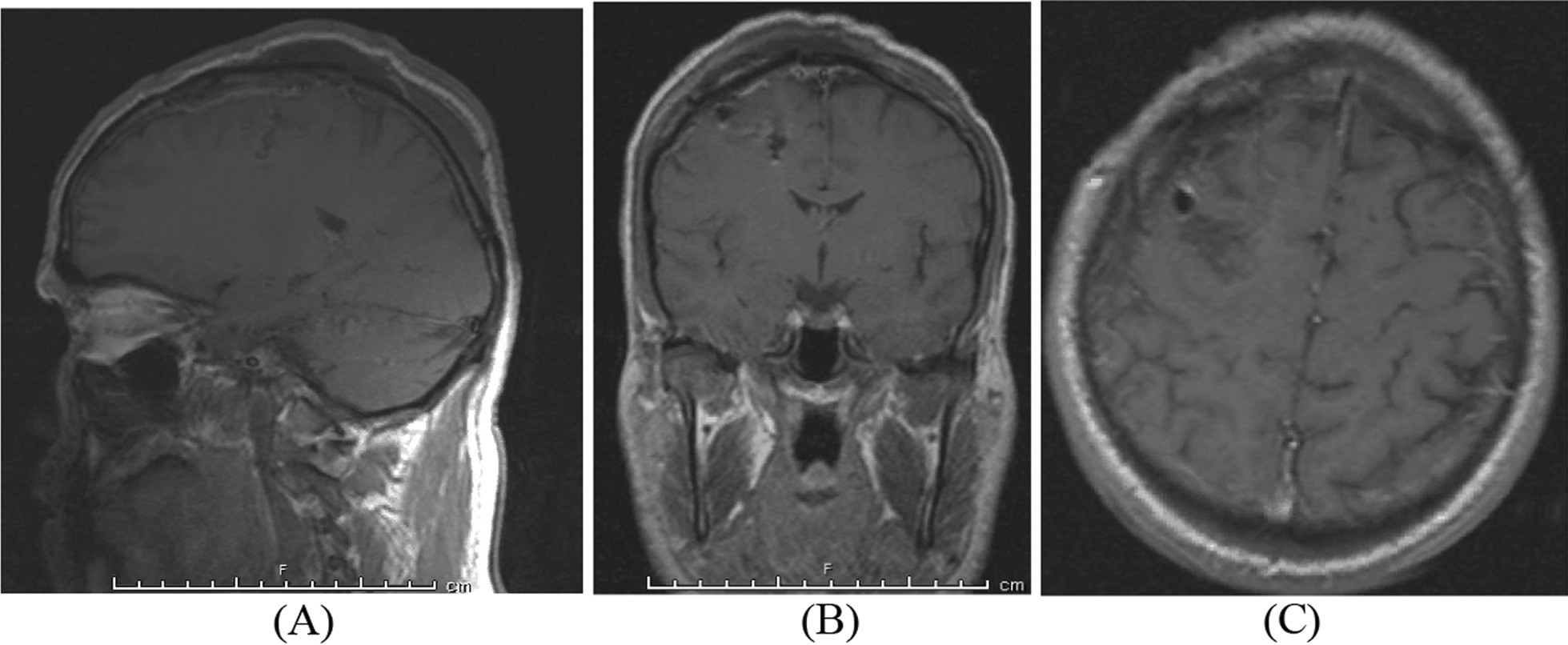 Fig. 15