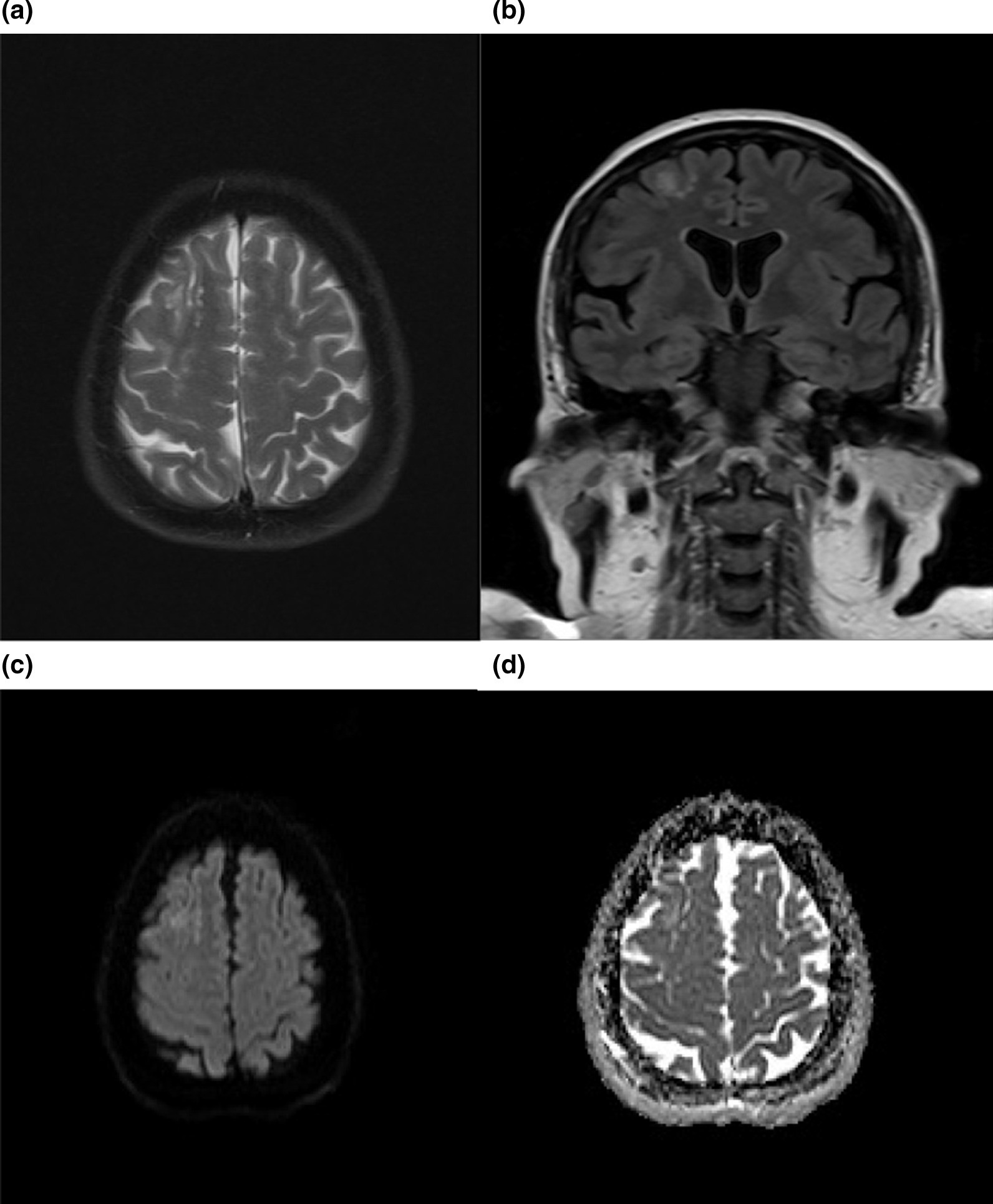 Fig. 2