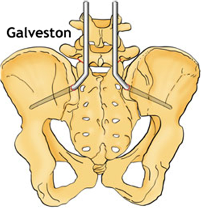 Fig. 10