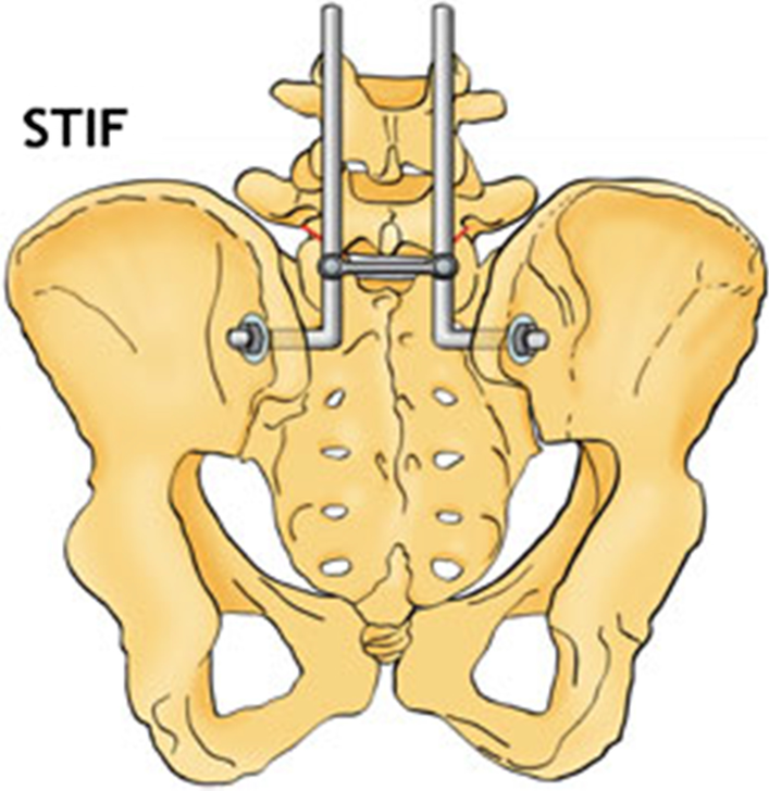 Fig. 11