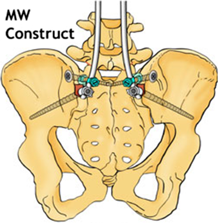 Fig. 14