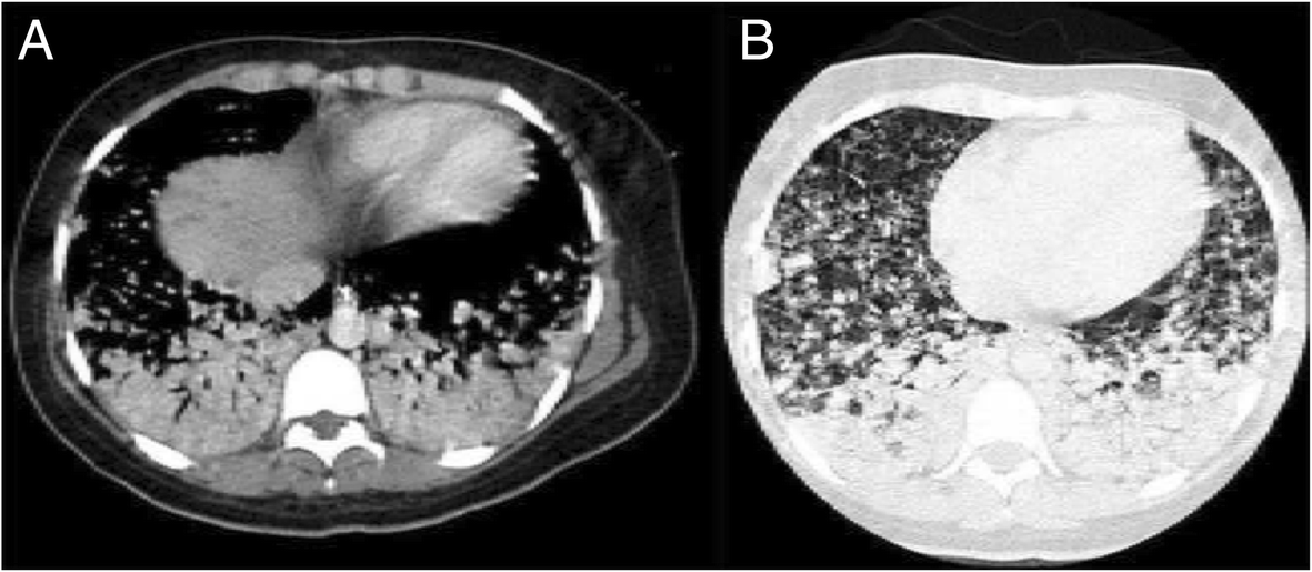 Fig. 6