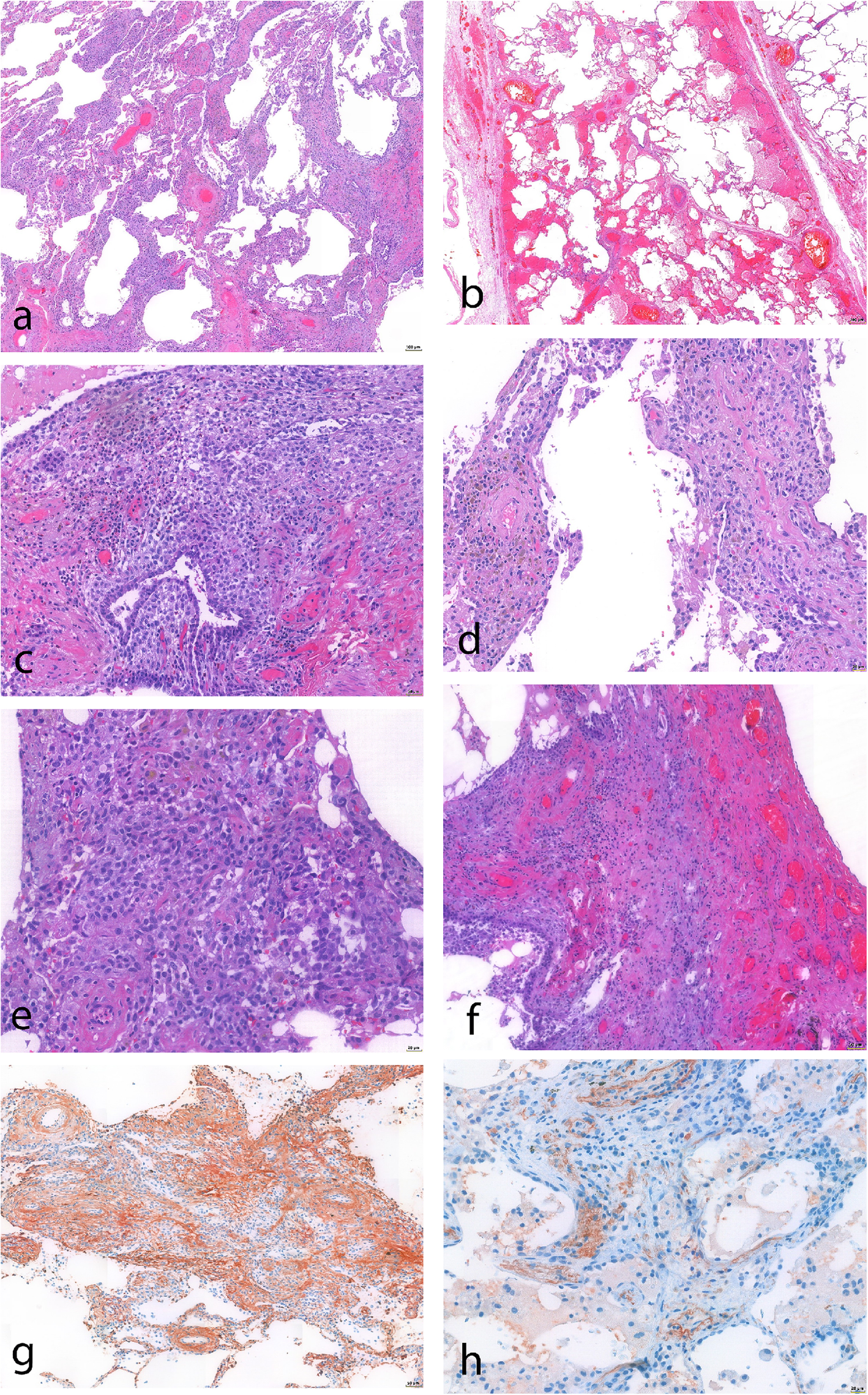 Fig. 13