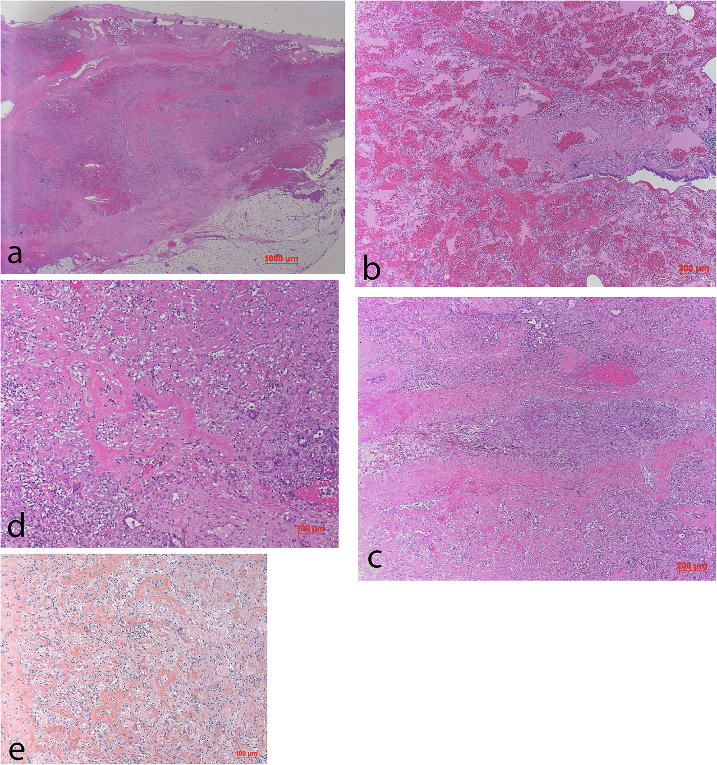 Fig. 18