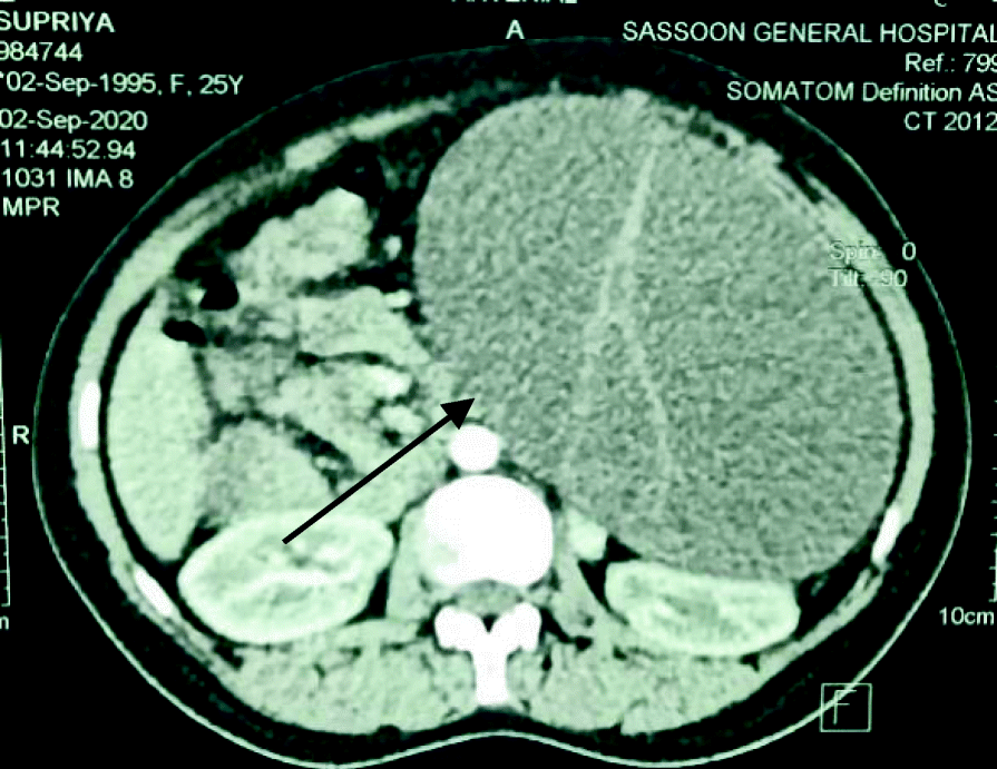 Fig. 1