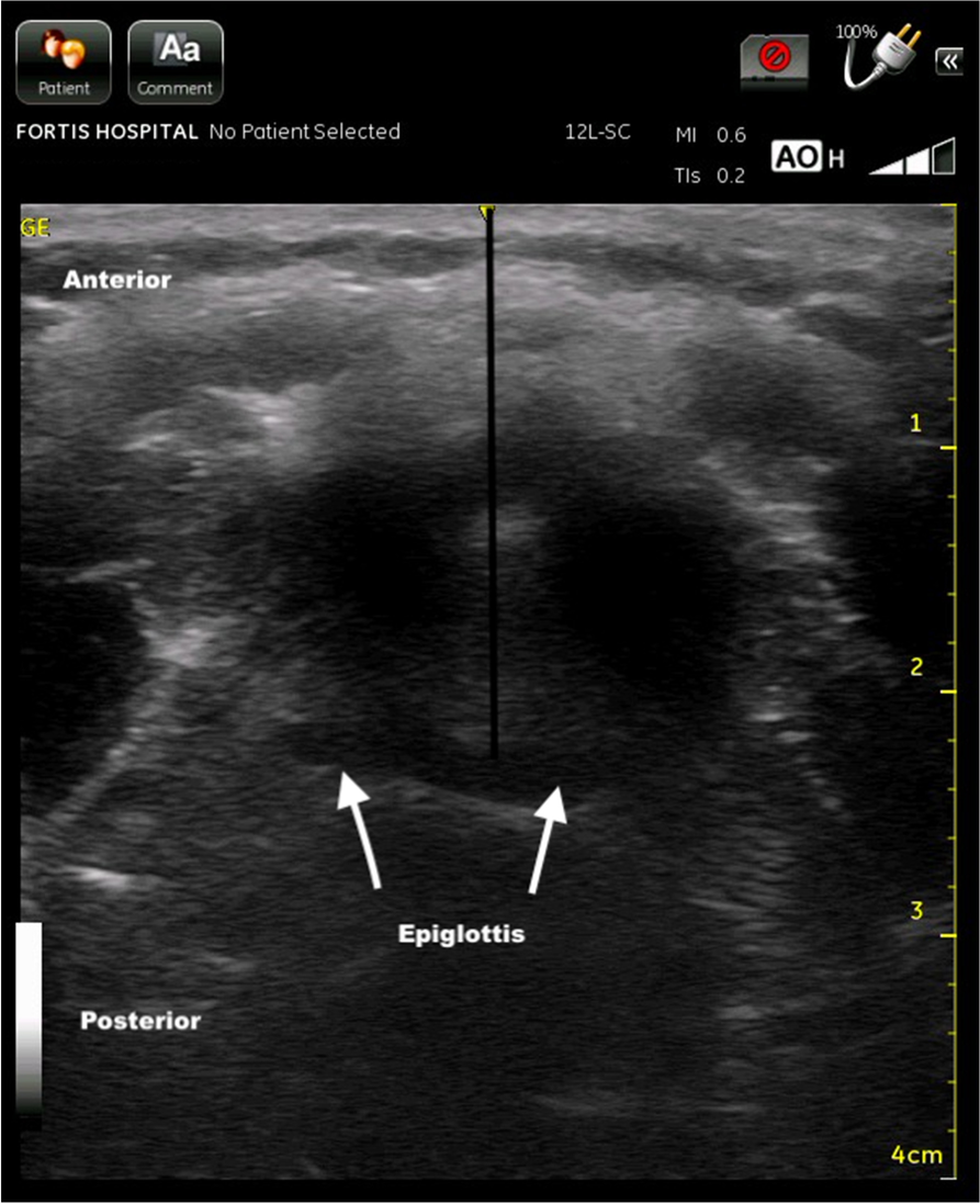 Fig. 2