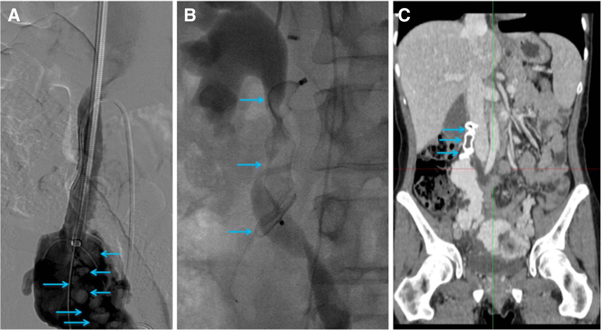 Fig. 4