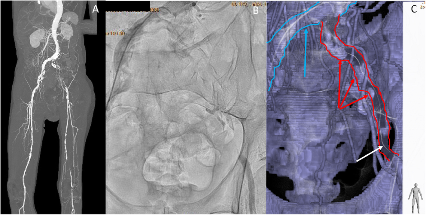 Fig. 2