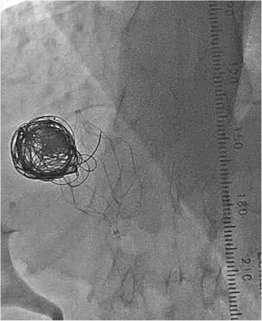 Fig. 4