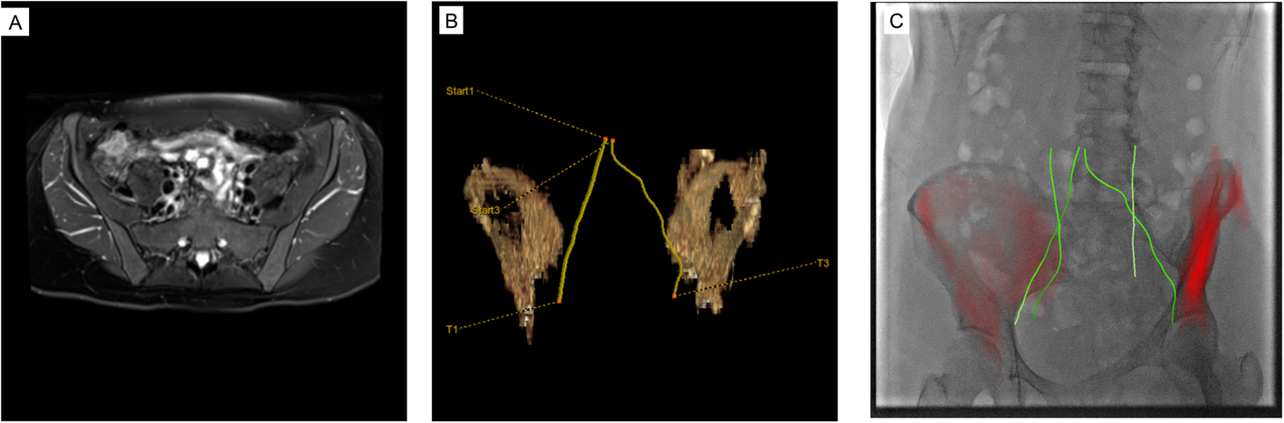 Fig. 3