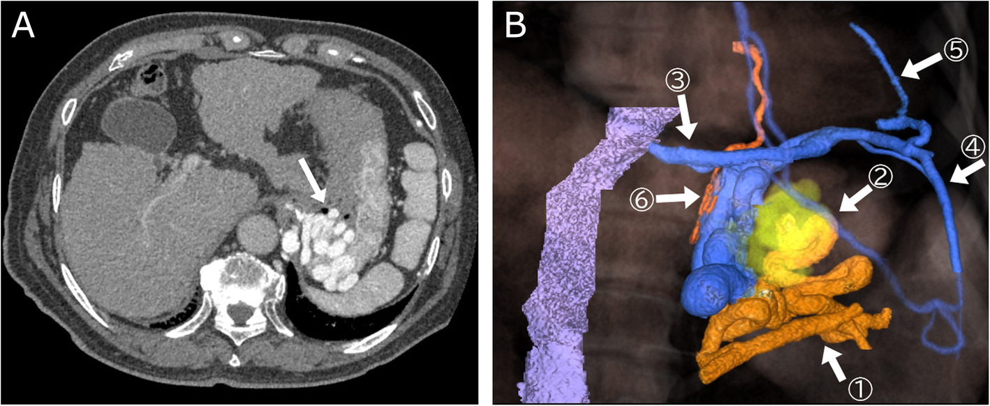 Fig. 1