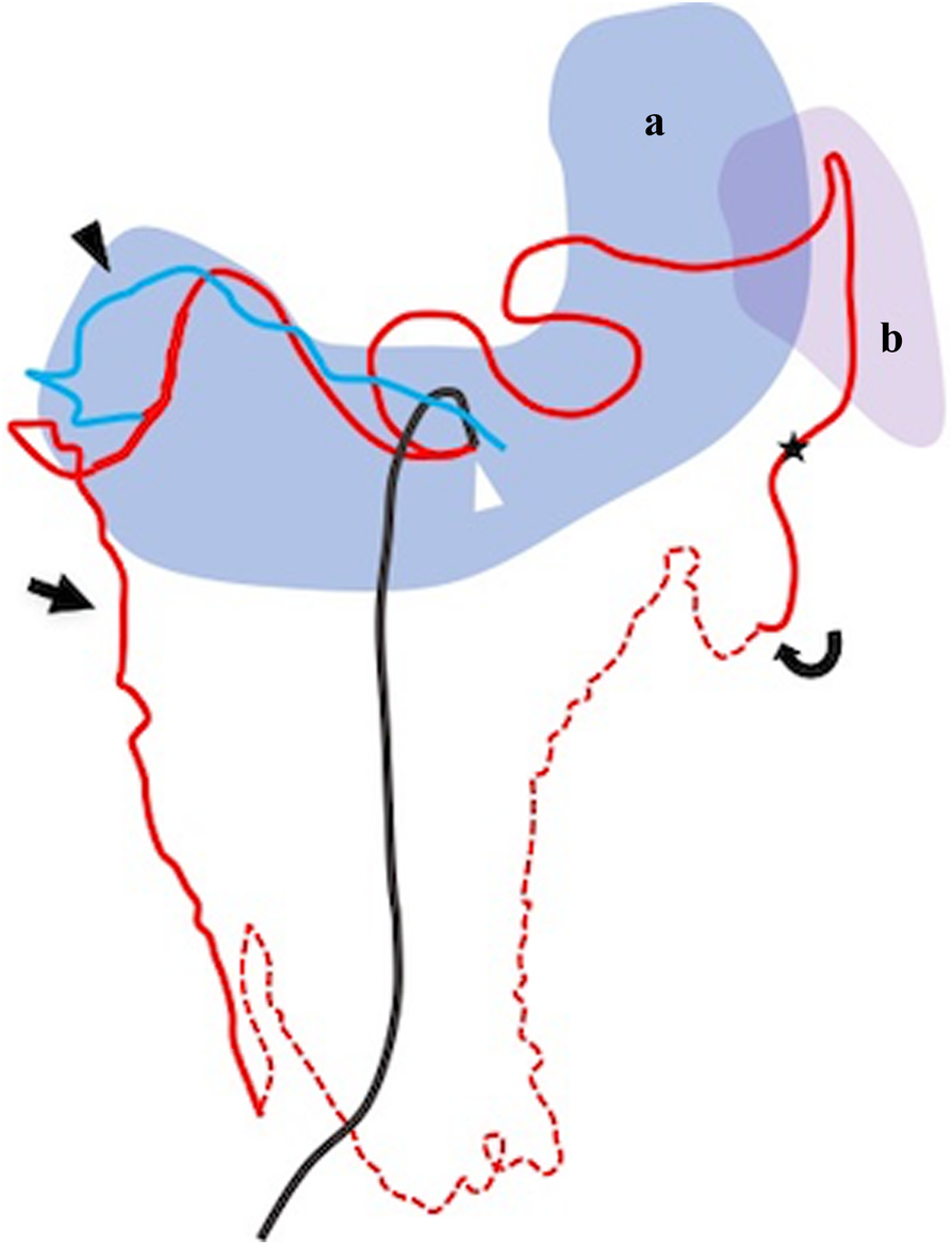 Fig. 3