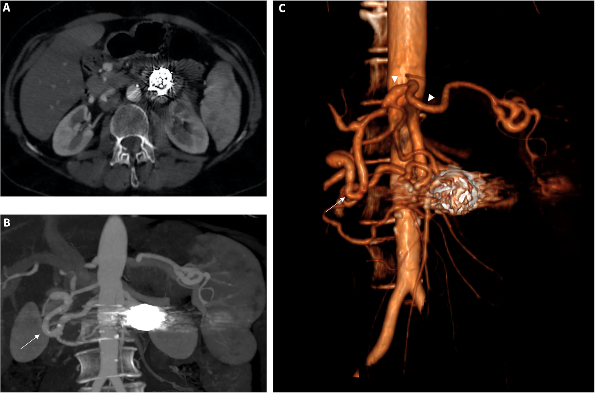 Fig. 3