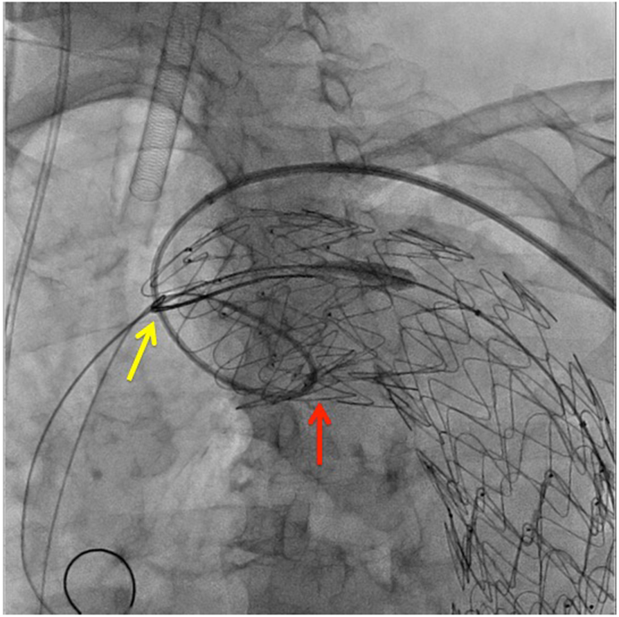 Fig. 3