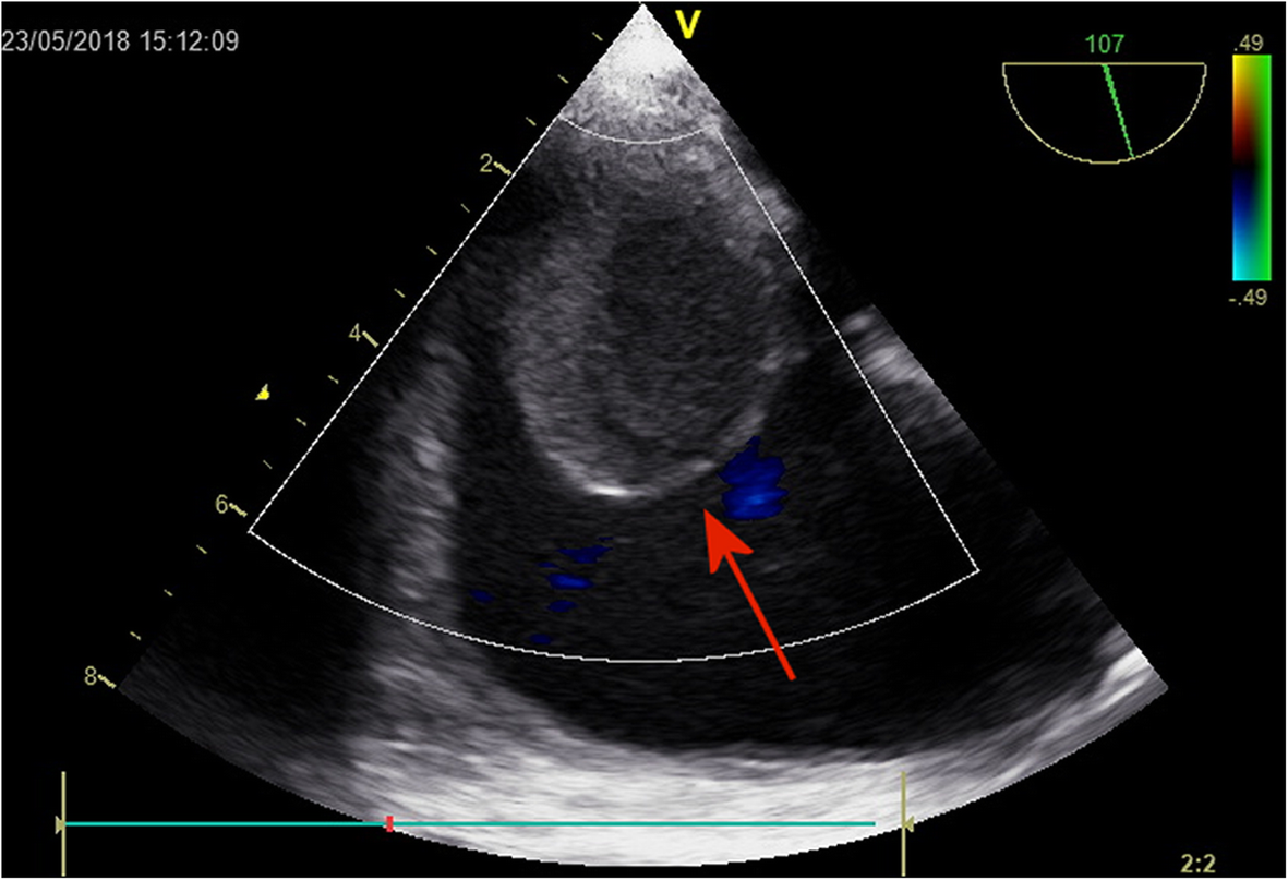 Fig. 1