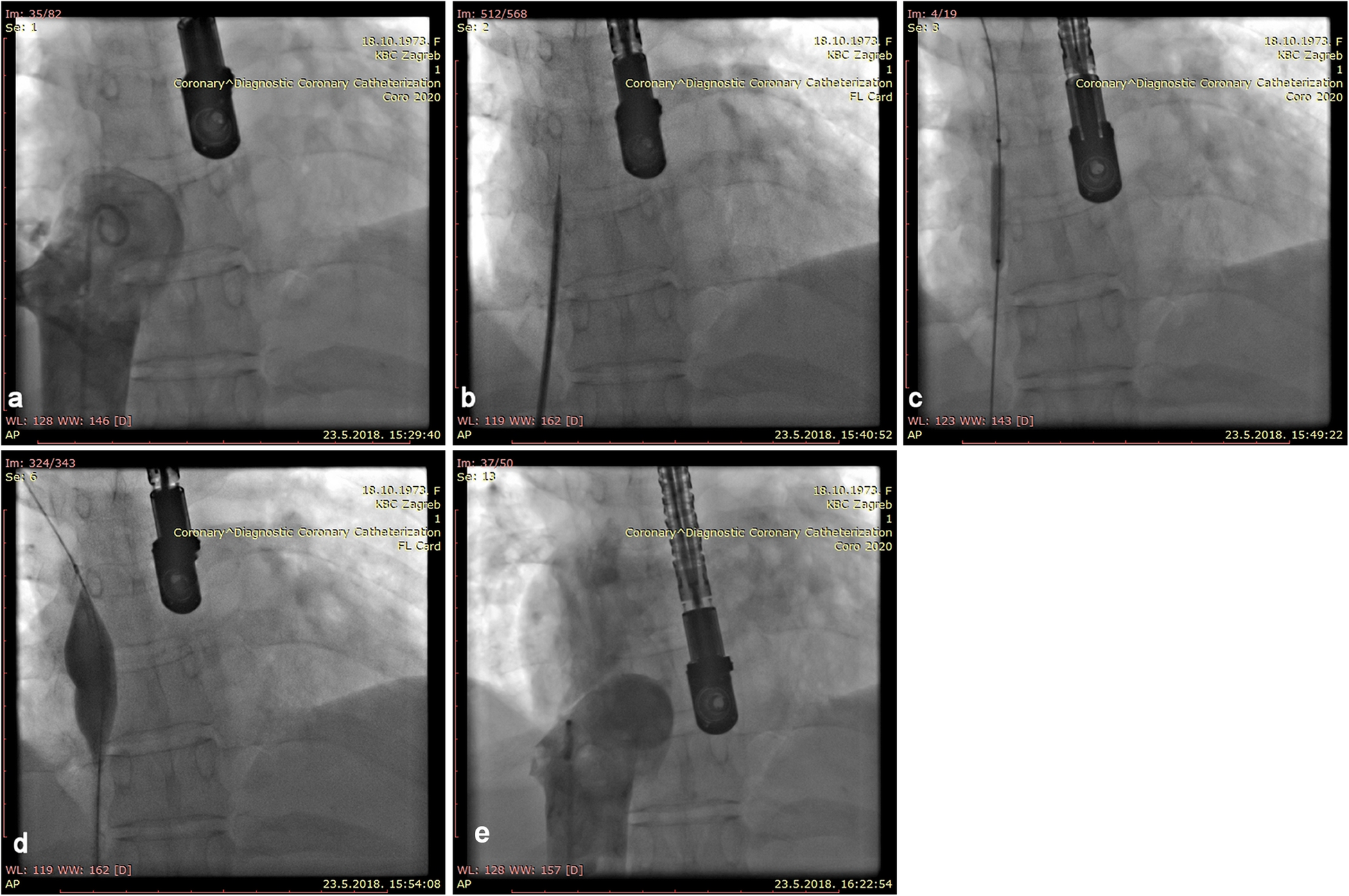 Fig. 3