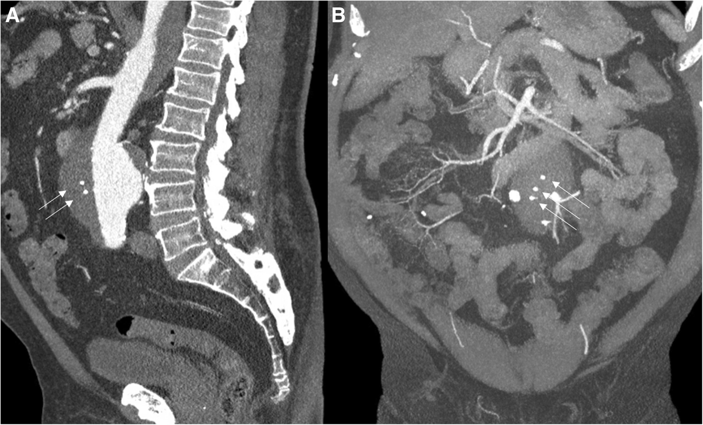 Fig. 4